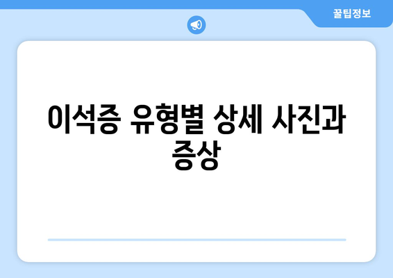 이석증 유형별 상세 사진과 증상