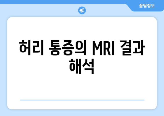 허리 통증의 MRI 결과 해석