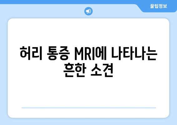 허리 통증 MRI에 나타나는 흔한 소견