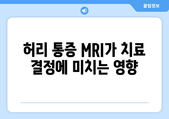 허리 통증 MRI가 치료 결정에 미치는 영향