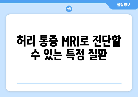 허리 통증 MRI로 진단할 수 있는 특정 질환