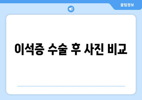 이석증 수술 후 사진 비교